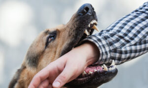How Can Our Crowley Personal Injury Lawyer Help You With a Dog Bite Injury Claim?