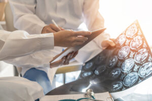What Is a Concussion?