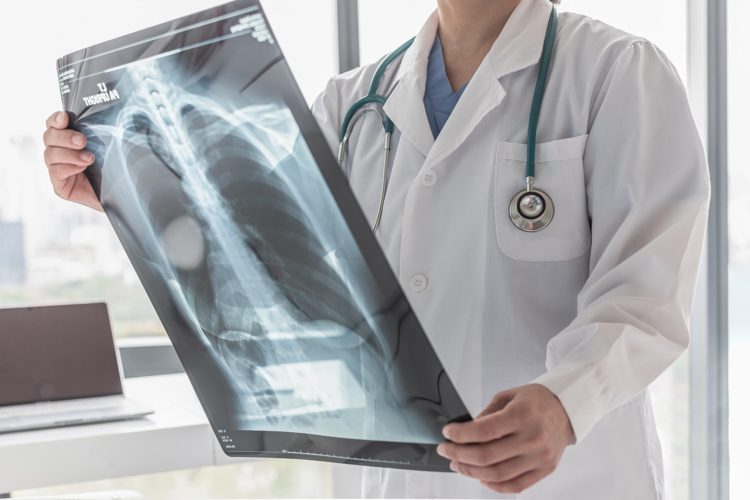 Symptoms of a Broken Tailbone