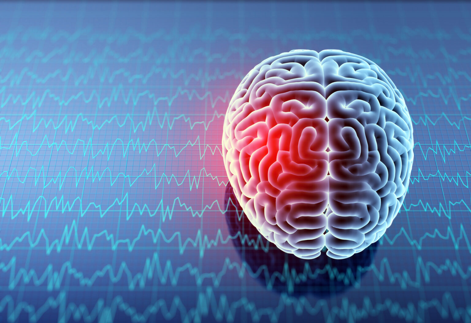 Lafayette Brain Injury Lawyer | Kenny Habetz Injury Law