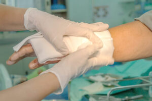 Degloving Injury